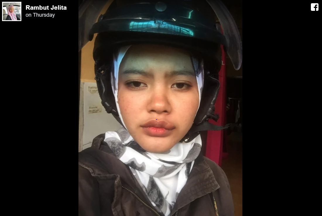 Dihinggap Serangga sewaktu Bawa Motosikal, Gadis Ini Kongsi Kisah Nya 2 2 2