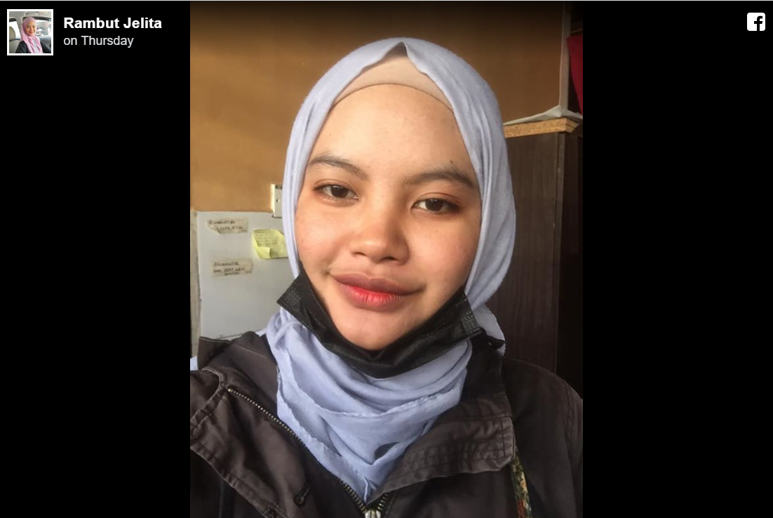 Dihinggap Serangga sewaktu Bawa Motosikal, Gadis Ini Kongsi Kisah Nya 8 8