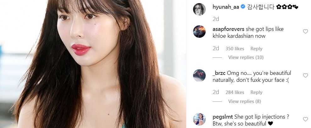 Bibir Kelihatan Mungil, Hyuna Dituduh Buat Pembedahan Plastik. Ini Jawapan Balas Beliau 1 bw271