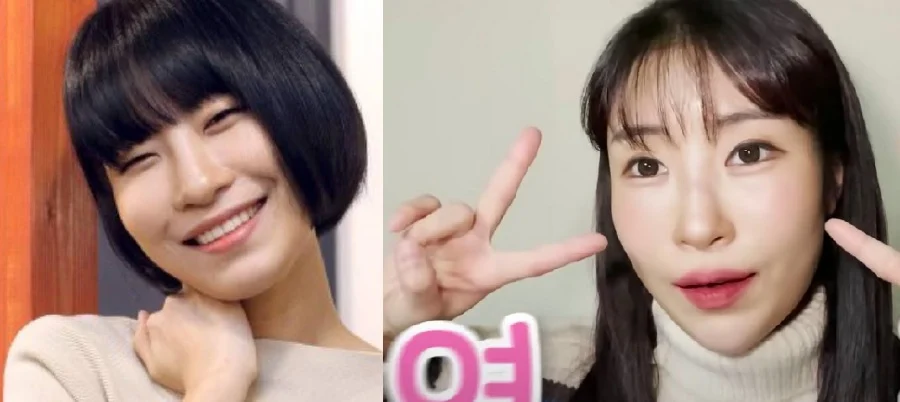 Lee Se Young a.k.a Hidayah Daebaking: "Saya Meminta Pembedahan Hidung Saya Seperti Dua Idola K-Pop Ini" 1 olsskcmdnps001a