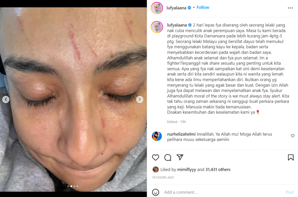 Lufya Diserang Lelaki Yang Cuba Menculik Anaknya, Netizen Tuduh Bekas Suami Jadi Dalang? 1 Screenshot 2022 06 29 120603
