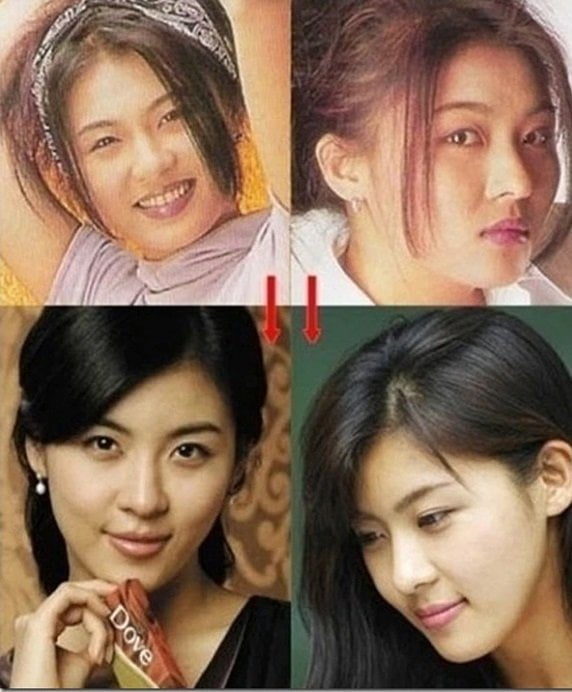 Artis Korea Ini Tiada ‘Job’ Kerana Terlalu Obses Dengan Pembedahan Plastik 5 jiwon