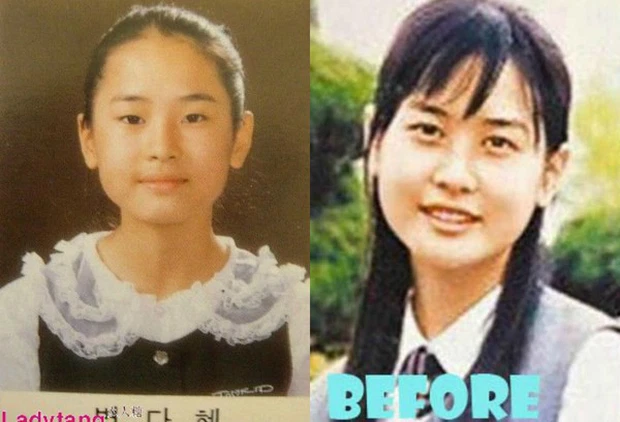 Artis Korea Ini Tiada ‘Job’ Kerana Terlalu Obses Dengan Pembedahan Plastik 3 lee da hee
