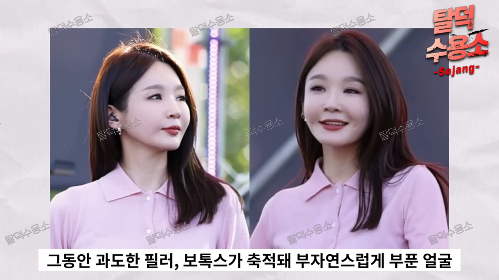Peminat Terkejut Lihat Wajah Kang Min Kyung Selepas Pembedahan Plastik, Nampak Tua! 5 1663623062 kang min kyung of koreas beauty davichi eventually has a side effect of plastic surgery 0 59 screenshot