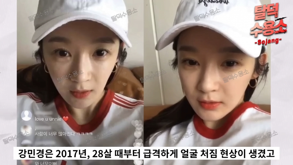 Peminat Terkejut Lihat Wajah Kang Min Kyung Selepas Pembedahan Plastik, Nampak Tua! 3 1663623614 image
