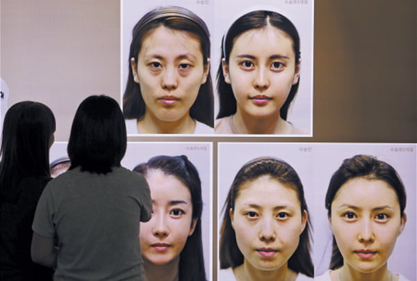 5 Artis Korea Mengaku Membuat Pembedahan Plastik 2 015C27E7 4EDD 45CD 8D72 FA52889034AF