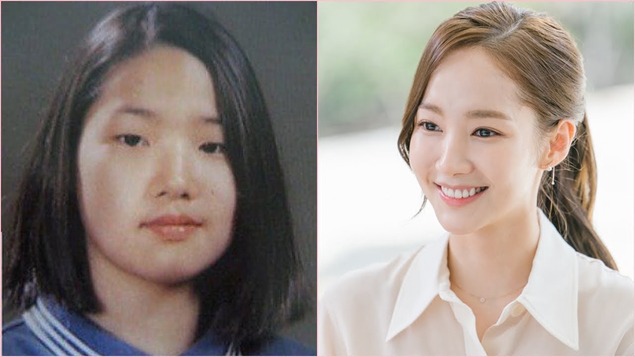5 Artis Korea Mengaku Membuat Pembedahan Plastik 3 74C01F1B 99B9 4929 AD97 E57BDDB8A0BE