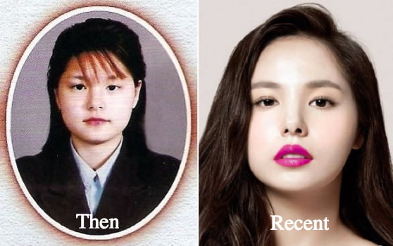 5 Artis Korea Mengaku Membuat Pembedahan Plastik 7 C6B56982 98BA 4F73 9CFA 1E2C5EE9A724