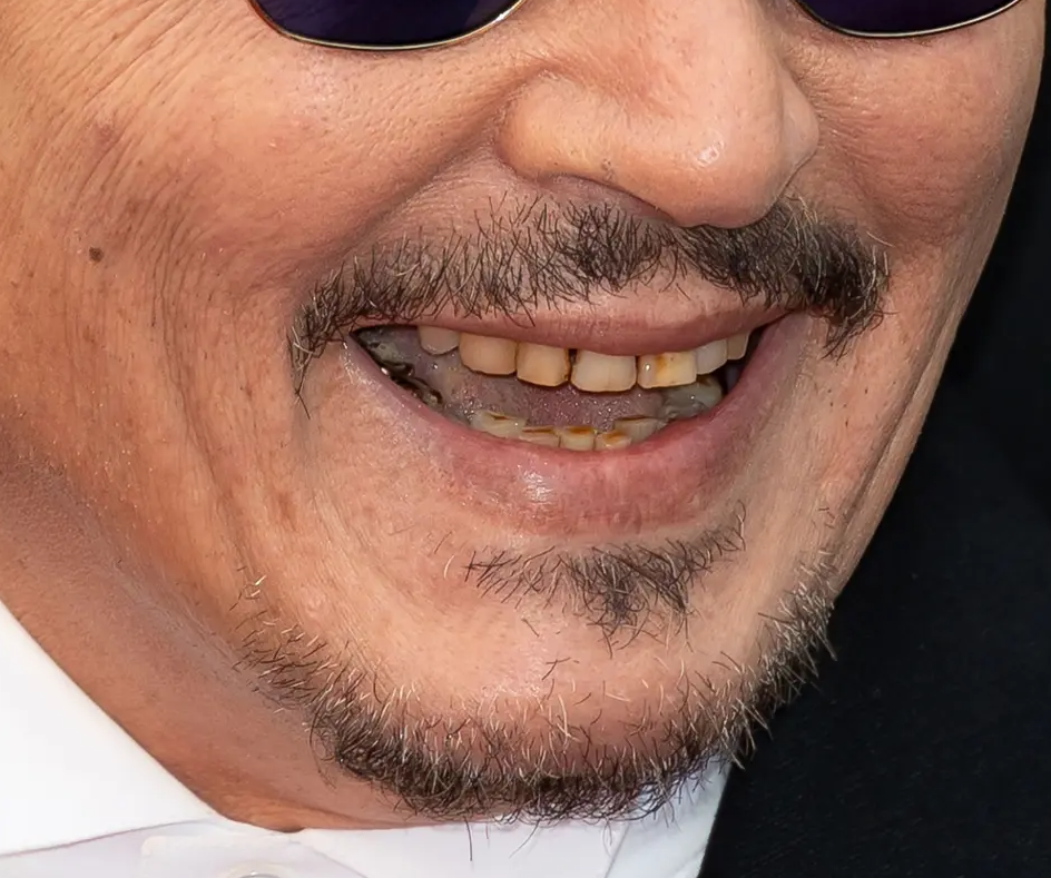 Hancur 'Mood' Peminat Johny Depp Apabila Lihat Gigi Nya, Warna Gigi Nya Buat Ramai Pening 3 daebaking.co johny3