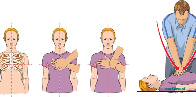Kena Serangan Jantung Ketika Menaiki Motor, Tindakan Pantas Wanita Selamatkan Lelaki Ini Raih Pujian 1 cpr