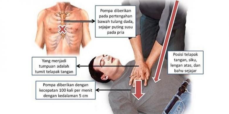 Kena Serangan Jantung Ketika Menaiki Motor, Tindakan Pantas Wanita Selamatkan Lelaki Ini Raih Pujian 2 cpr1