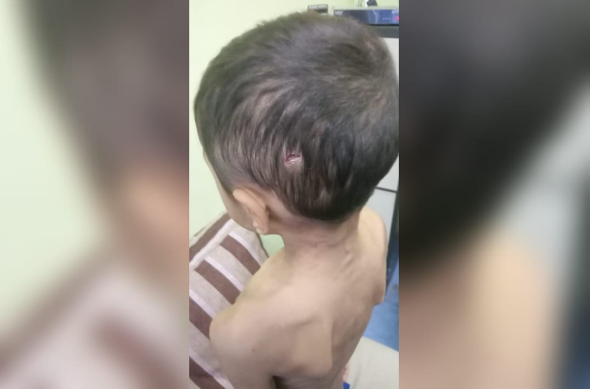 Tak Tahan Didera Bapa Kandung dan Ibu Tiri, sekali Budak 6 Tahun Berjaya Larikan Diri 1 dera 2