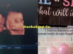 “Dah Beli 30 Helai Baju Girl..”- Terkejut Bayi Bertukar Jantina, Ini Reaksi Si Ibu Buat Ramai Tak Sangka