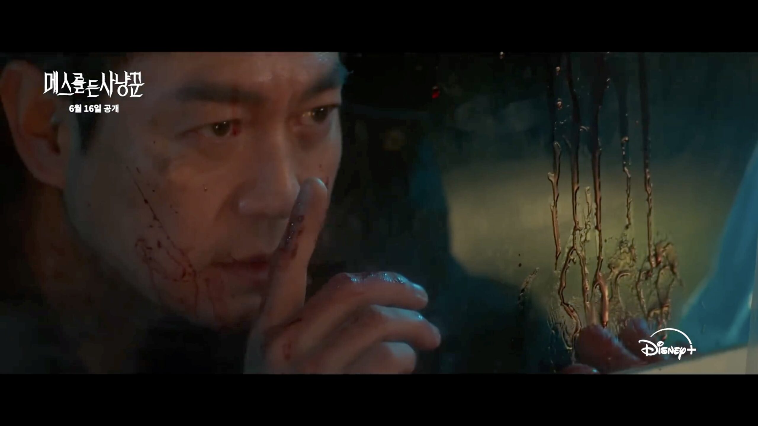Anak Sang Pembunuh, Pertarungan Gelap Seo Se Hyun dalam Hunter with a Scalpel, Psikopat Seperti Bapanya? 7 Se hyun